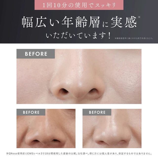 NIPLUXQ Nose 鼻專用美顏器 EMS + 鼻夾 + 藍光 LED 縮鼻翼夾【香港行貨】