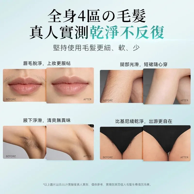 Jujy 紀芝 雙燈管藍寶石冰點極速連閃無痛嫩膚全身家用脫毛儀 PRO 2.0【香港行貨】