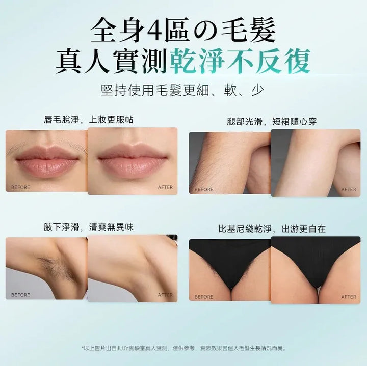 Jujy 紀芝 雙燈管藍寶石冰點極速連閃無痛嫩膚全身家用脫毛儀 PRO 2.0【香港行貨】